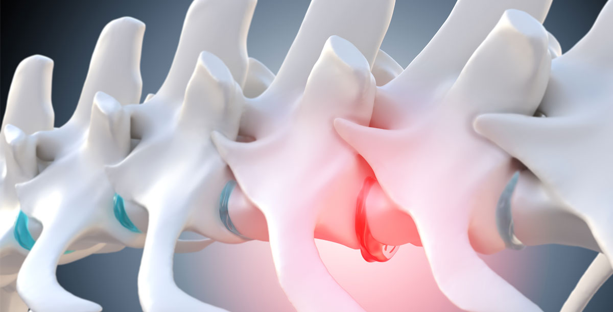 Bandscheibenvorfall beim Hund - Ursachen, Symptome, Heilung